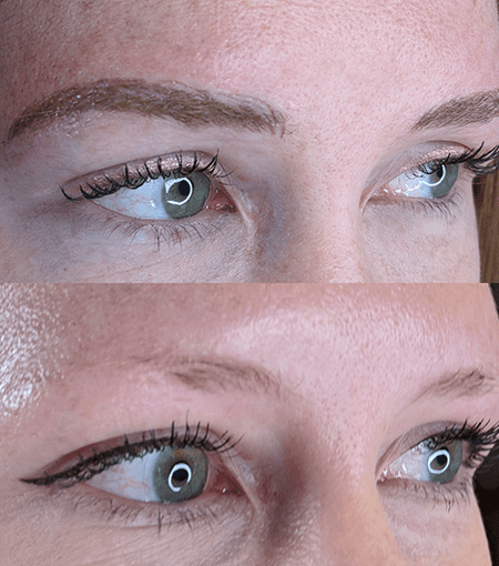 befor and after microblading